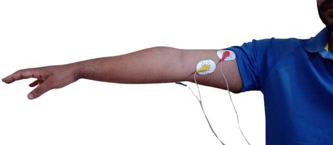 Electrode Placement