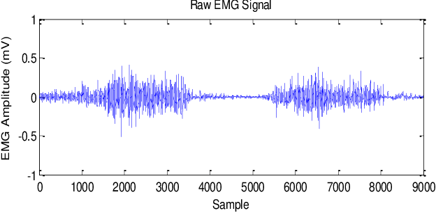 Raw EMG Signal